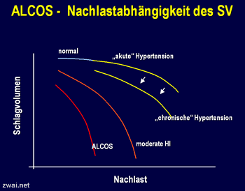 Acute Low Cardiac Output Syndrome - ALCOS in der Intensivmedizin